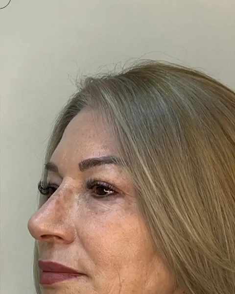 Full Face, depois
