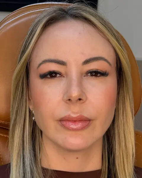 Daiane, depois