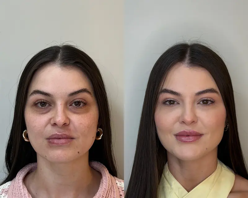 Luana antes e depois, de frente
