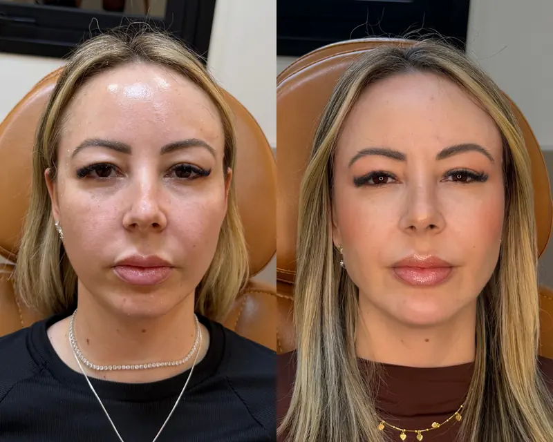 Daiane antes e depois, de frente